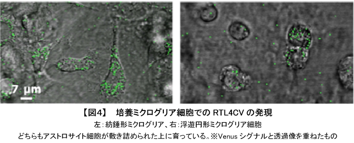 自閉症４.png