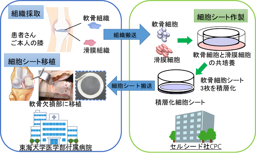  ACI 手順には何が含まれますか?